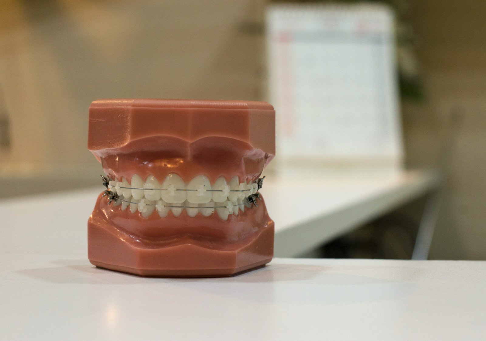 implantes dentales