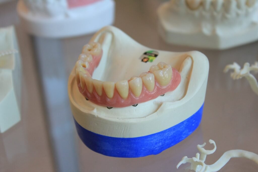 cirugía e implantes dentales
